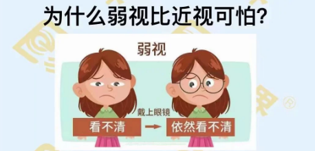 為什么弱視比近視可怕？