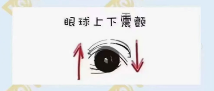 什么是眼球震顫？